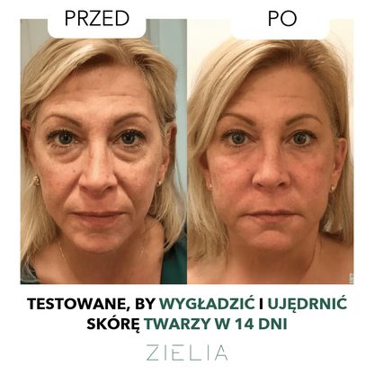 Szczotka do drenażu limfatycznego